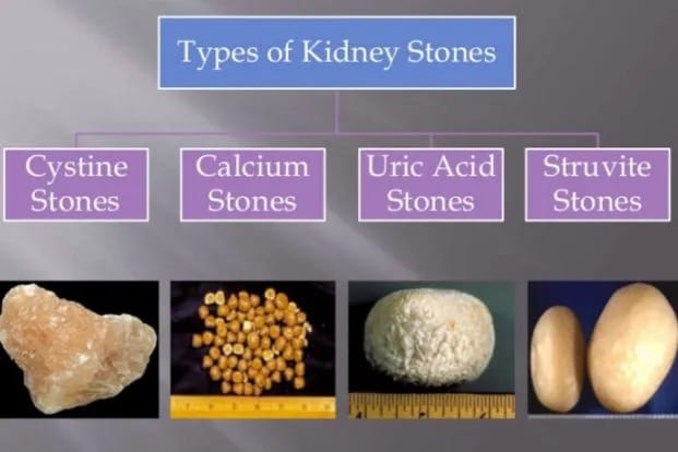 Best Urologist in Kanpur